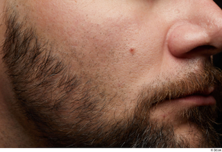  HD Face Skin Arthur Fuller cheek face lips mouth nose skin pores skin texture 0001.jpg